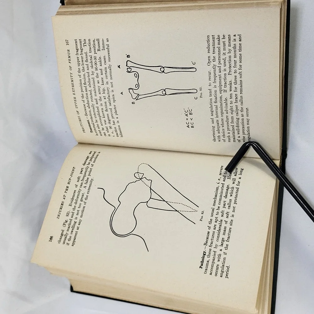 1947 A Manual of Fractures and Dislocations Barbara Stimson 2nd Ed Medical Book